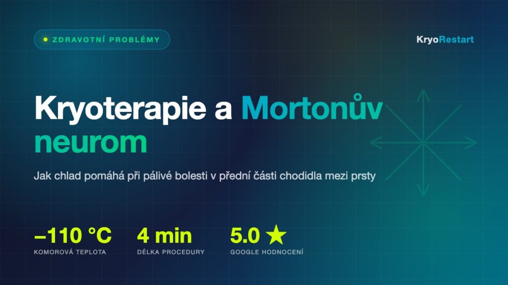 Kryoterapie a Mortonův neurom – úleva od bolesti chodidla