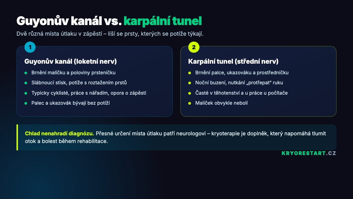 Rozdíl mezi syndromem Guyonova kanálu a syndromem karpálního tunelu – které prsty brní